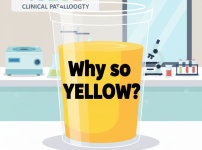 임상병리실의 소변검사