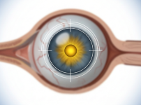 황반 중심부에 영양을 공급하는지아잔틴